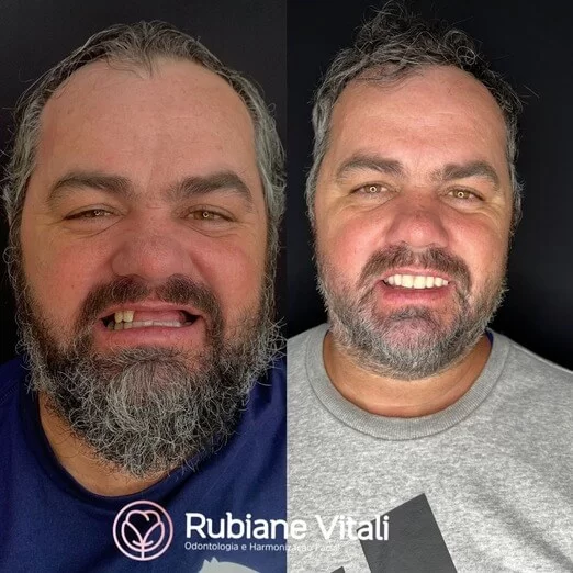 Antes-e-depois-2.jpeg