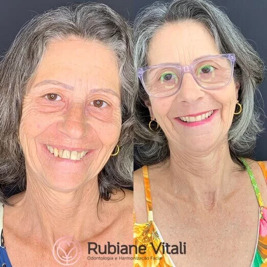 Antes-e-depois-3.jpeg