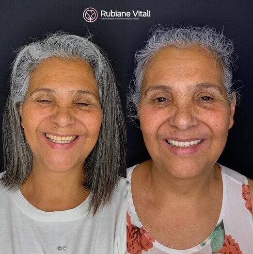 Antes-e-depois-4.jpeg