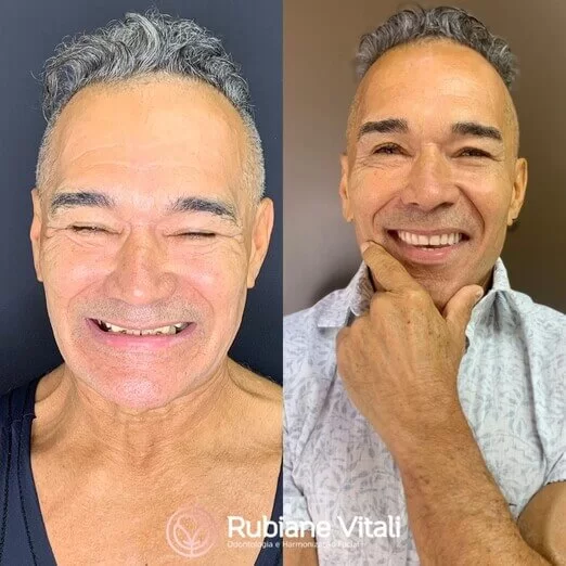 Antes-e-depois-5.jpeg