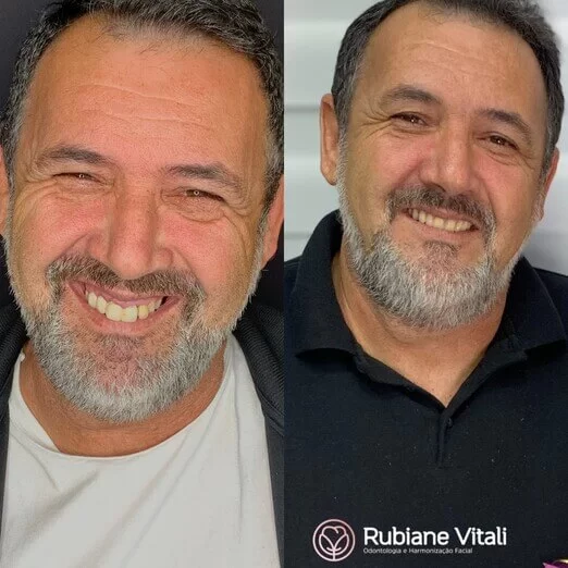 Antes-e-depois-6.jpeg
