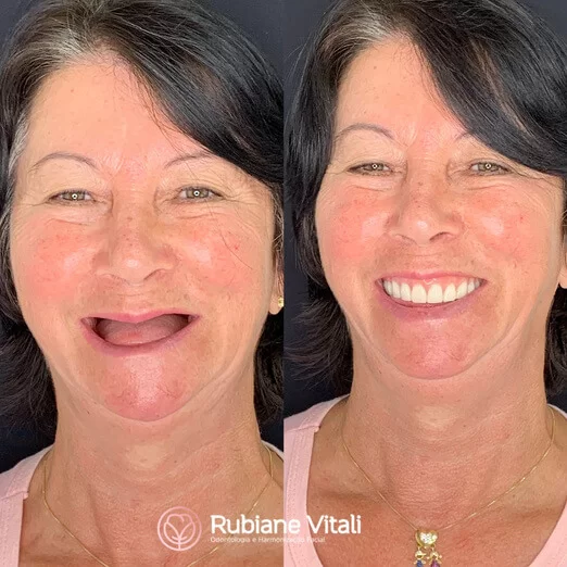 antes-e-depois-7-copiar.jpg